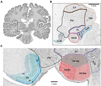 Cytoarchitectonic Maps of the Human Metathalamus in 3D Space